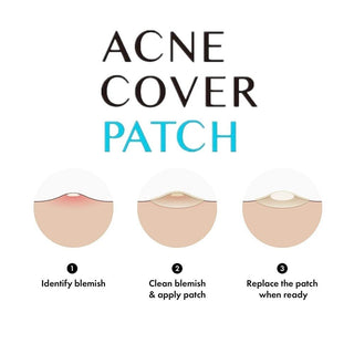Acne Patches with Hydrocolloid 20pcs Acne Patches - Kormesic -  - JKbeauty